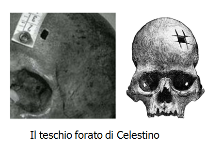Orecchini A Lobo Teschio E Tibie Incrociate In Argento 925 - Extra Small Con Occhi In Cristallo Nero, 0,7x0,5 Cm